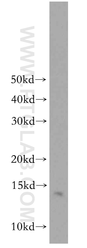 Western Blot (WB) analysis of mouse brain tissue using LDLRAD1 Polyclonal antibody (20096-1-AP)