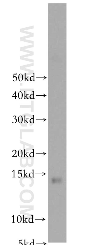 Western Blot (WB) analysis of mouse liver tissue using LDLRAD1 Polyclonal antibody (20096-1-AP)