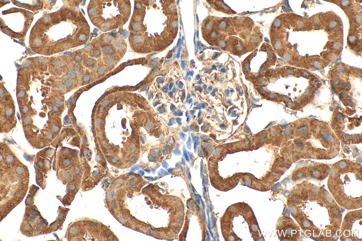 Immunohistochemistry (IHC) staining of mouse kidney tissue using ARH Polyclonal antibody (13213-1-AP)