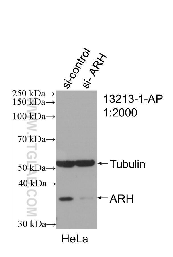 Western Blot (WB) analysis of HeLa cells using ARH Polyclonal antibody (13213-1-AP)