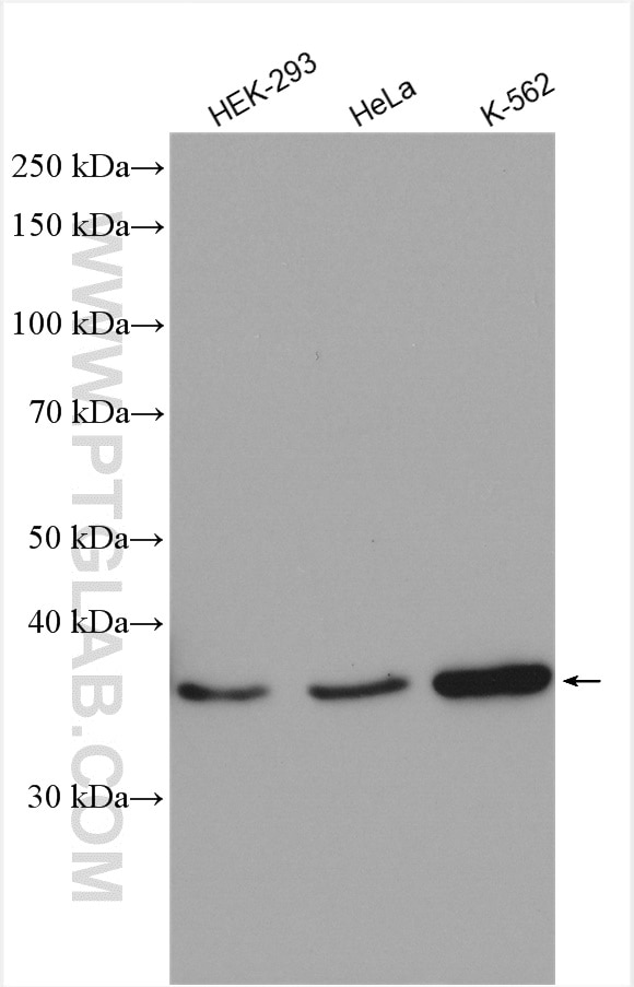 Western Blot (WB) analysis of various lysates using ARH Polyclonal antibody (13213-1-AP)