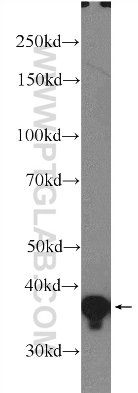 ARH Polyclonal antibody