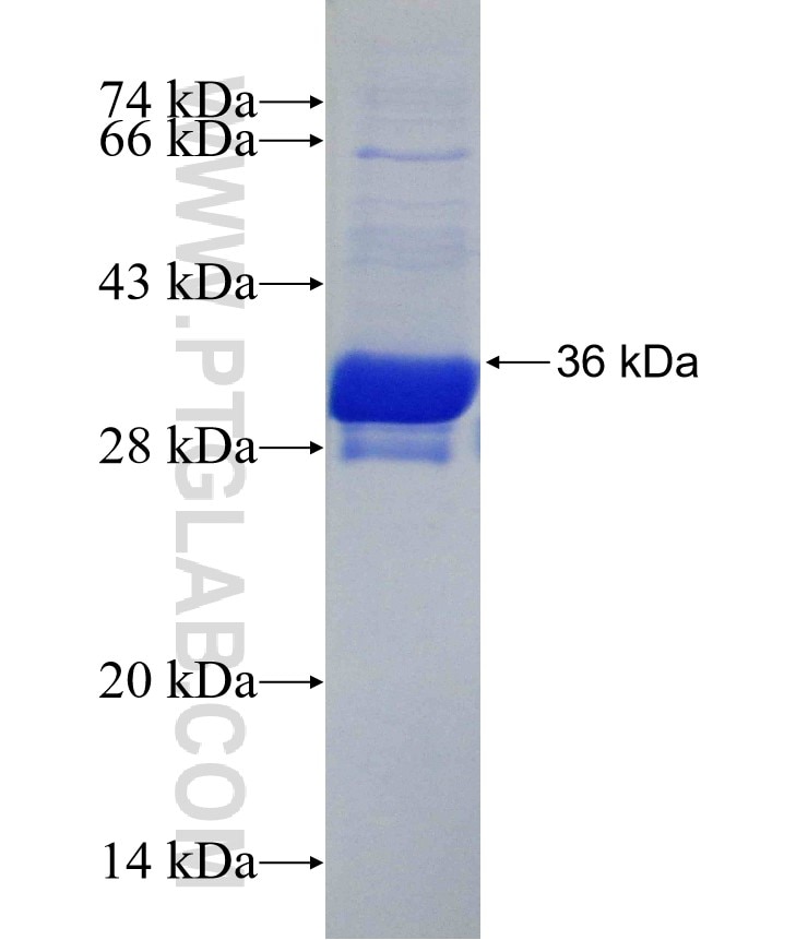 LDLRAP1 fusion protein Ag30418 SDS-PAGE