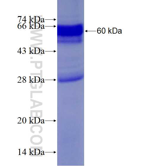 LDLRAP1 fusion protein Ag4006 SDS-PAGE