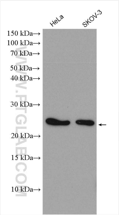 Western Blot (WB) analysis of HeLa cells using LDOC1 Polyclonal antibody (10113-2-AP)