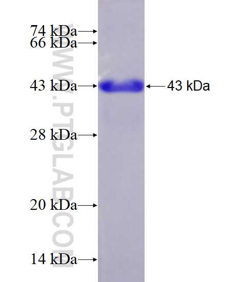 LDOC1 fusion protein Ag0158 SDS-PAGE