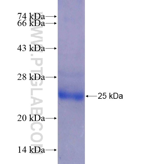 LECT2 fusion protein Ag21623 SDS-PAGE