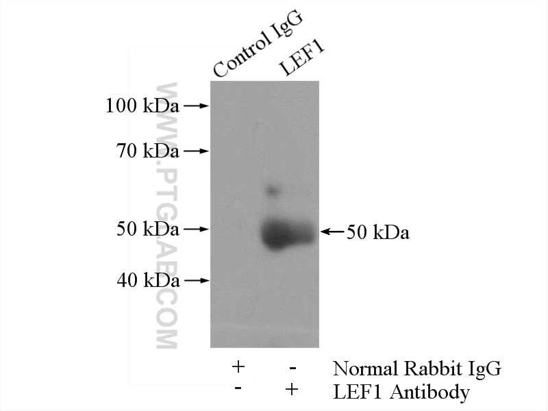 Immunoprecipitation (IP) experiment of SW 1990 cells using LEF1 Polyclonal antibody (14972-1-AP)
