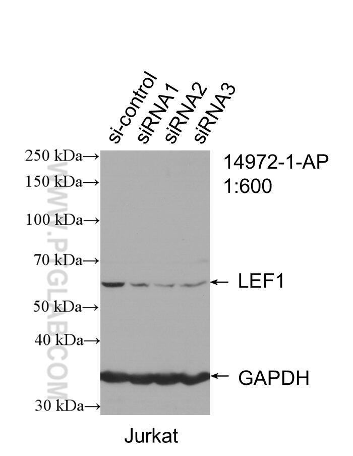 WB analysis of Jurkat using 14972-1-AP