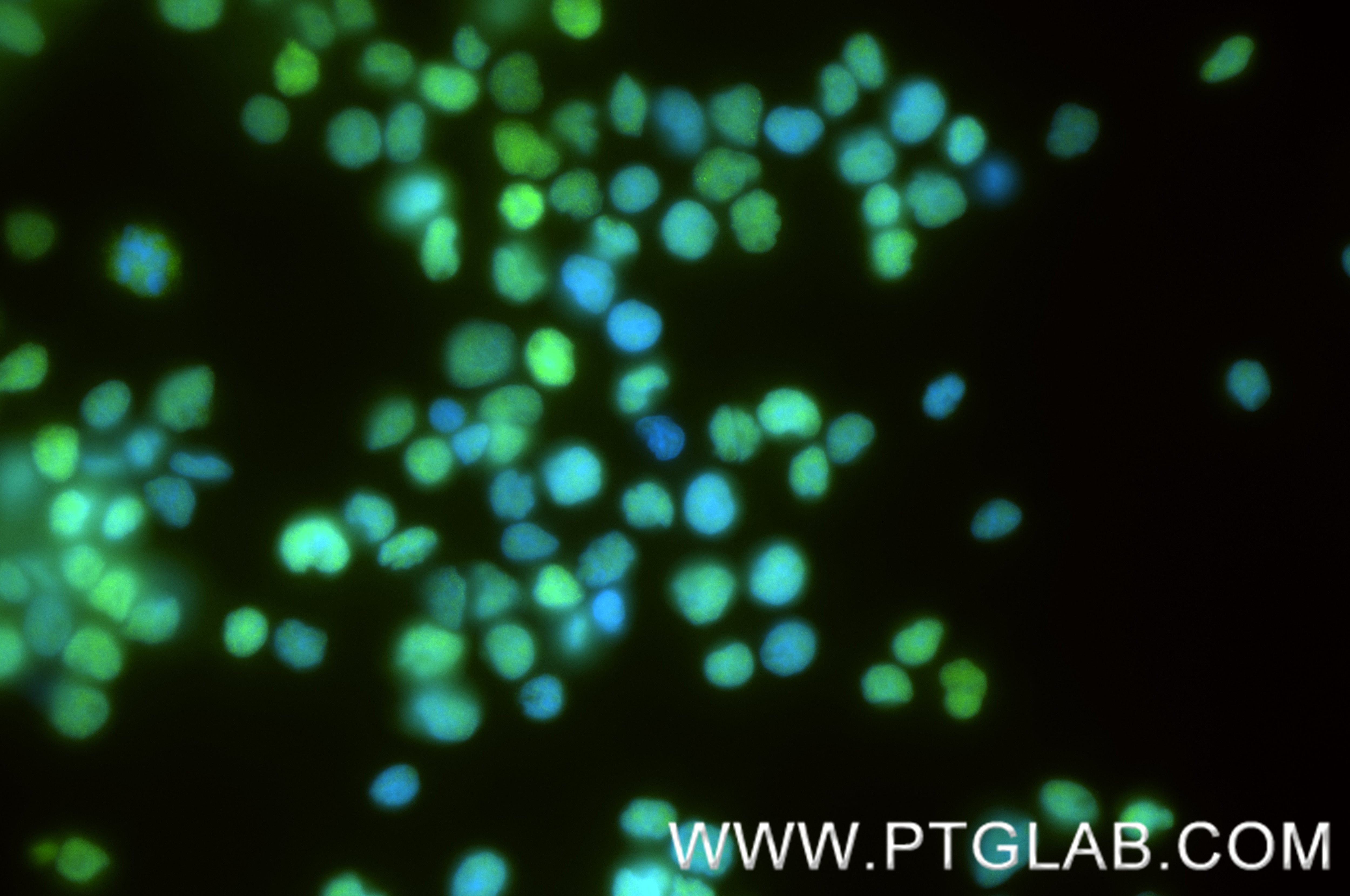 IF Staining of Jurkat using 88437-2-RR (same clone as 88437-2-PBS) Immunofluorescence (IF) / fluorescent staining of Jurkat cells using LEF1 Recombinant monoclonal antibody (88437-2-RR)