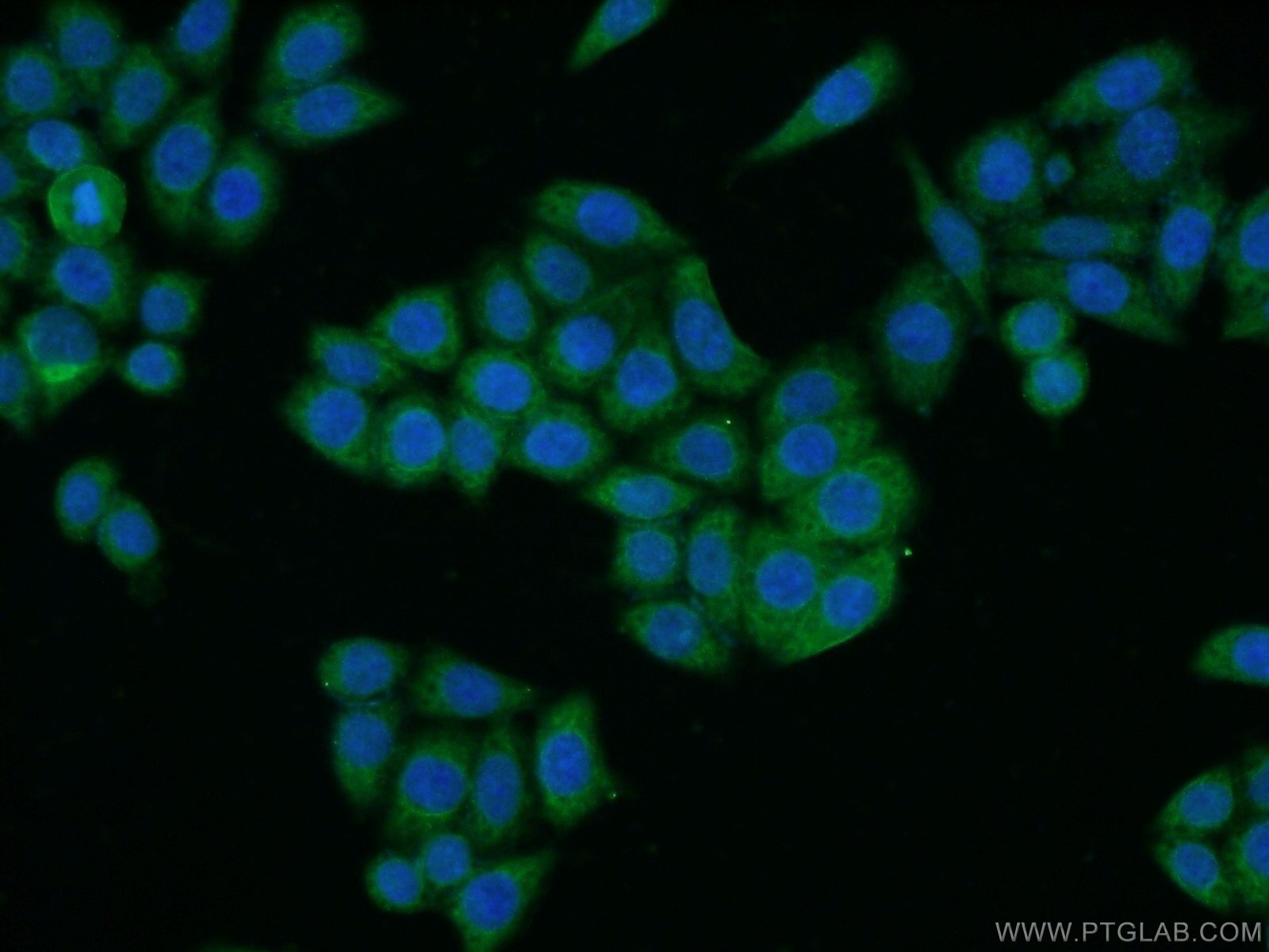 Immunofluorescence (IF) / fluorescent staining of HeLa cells using LEFTY2 Polyclonal antibody (13991-1-AP)