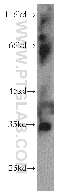 Western Blot (WB) analysis of mouse uterus tissue using LEFTY2 Polyclonal antibody (13991-1-AP)