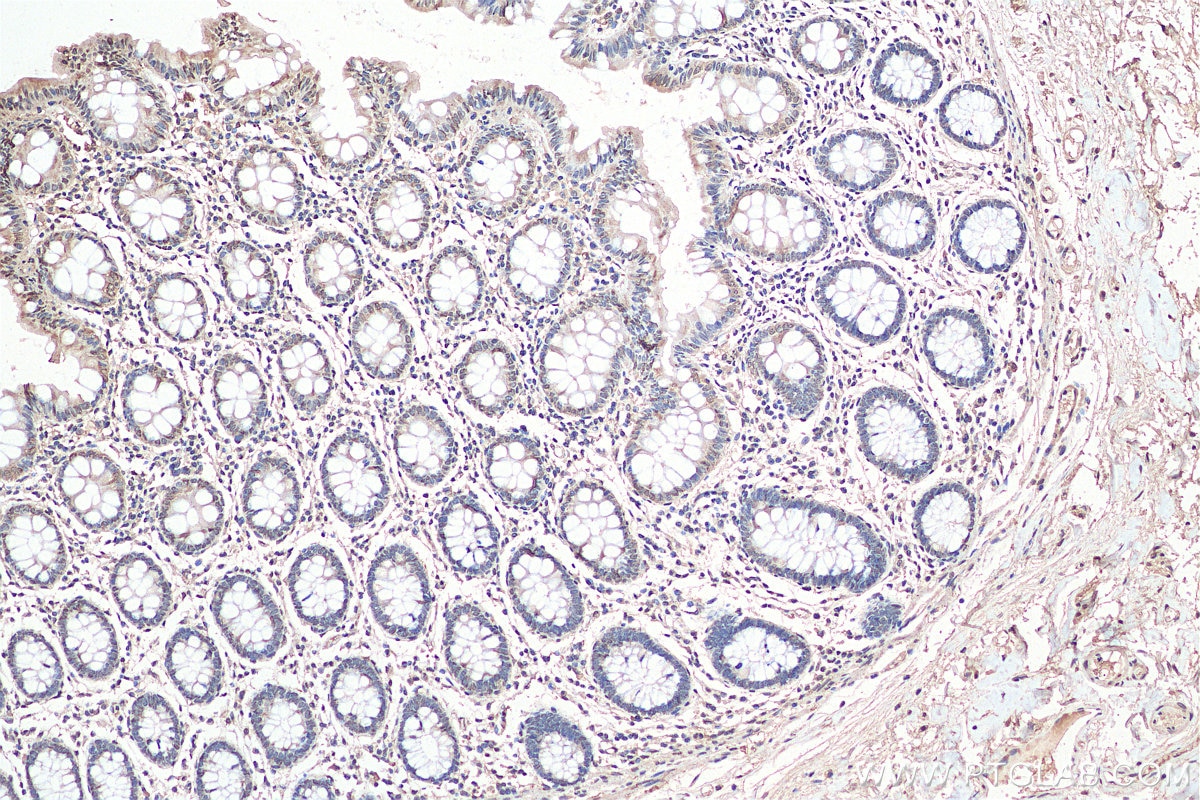 Immunohistochemistry (IHC) staining of human colon tissue using LEMD2 Polyclonal antibody (29406-1-AP)