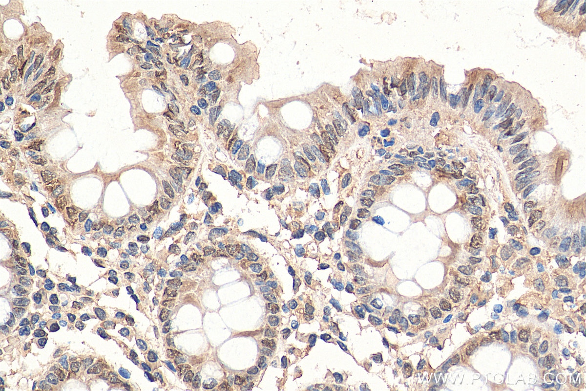 Immunohistochemistry (IHC) staining of human colon tissue using LEMD2 Polyclonal antibody (29406-1-AP)