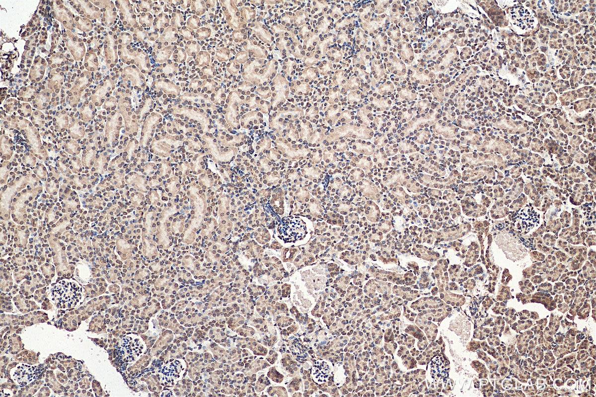 Immunohistochemistry (IHC) staining of mouse kidney tissue using LEMD2 Polyclonal antibody (29406-1-AP)