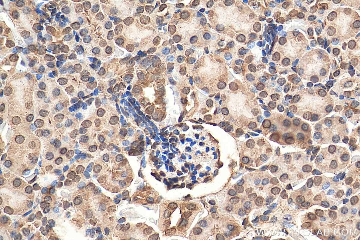 Immunohistochemistry (IHC) staining of mouse kidney tissue using LEMD2 Polyclonal antibody (29406-1-AP)