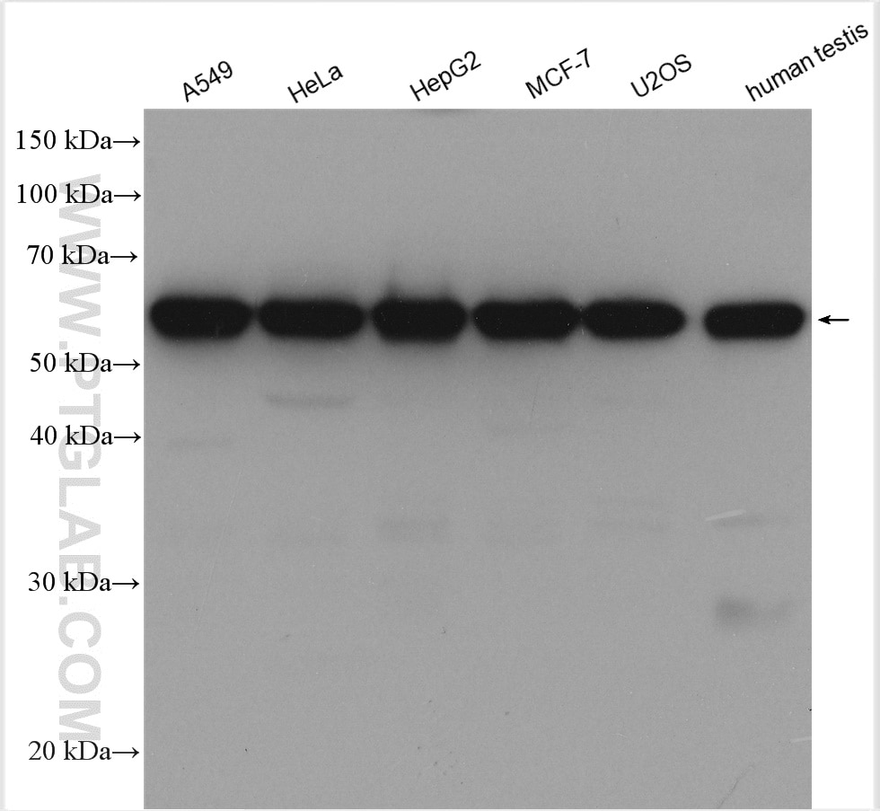 Western Blot (WB) analysis of various lysates using LEMD2 Polyclonal antibody (29406-1-AP)