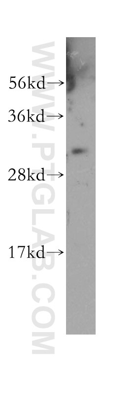 Western Blot (WB) analysis of human skin tissue using LENG1 Polyclonal antibody (11406-1-AP)