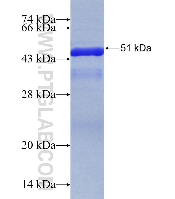 LENG8 fusion protein Ag31464 SDS-PAGE