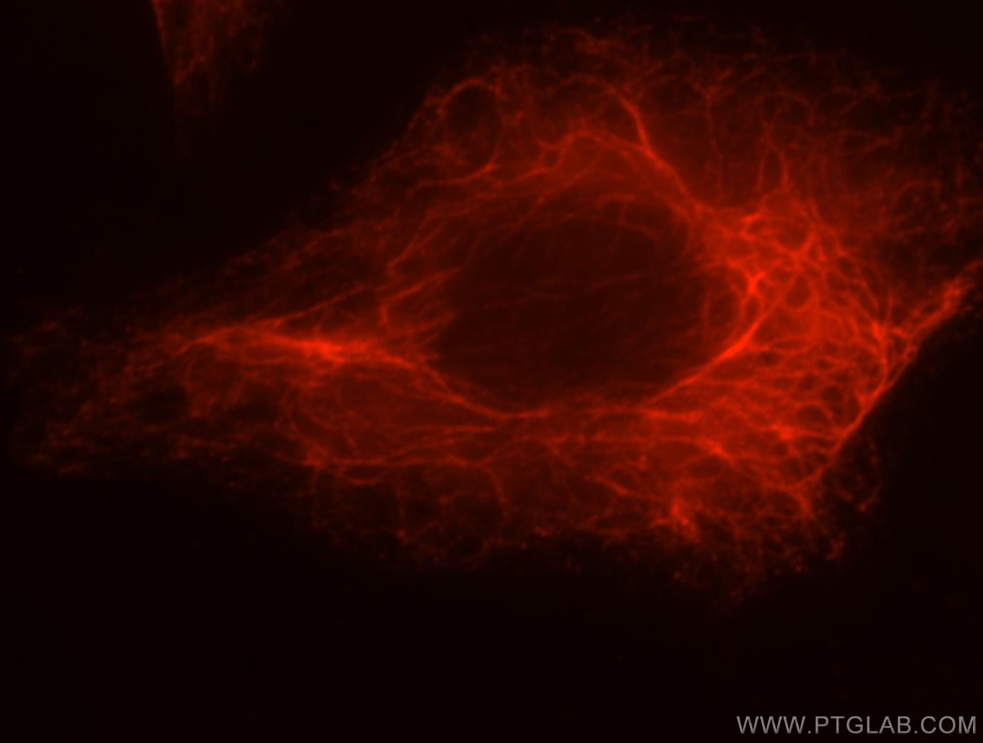 Immunofluorescence (IF) / fluorescent staining of HeLa cells using LENG9 Polyclonal antibody (16295-1-AP)