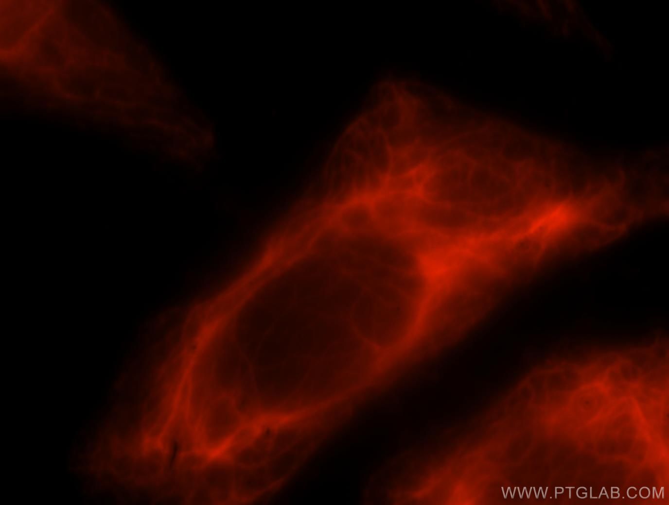 Immunofluorescence (IF) / fluorescent staining of MCF-7 cells using LENG9 Polyclonal antibody (16295-1-AP)