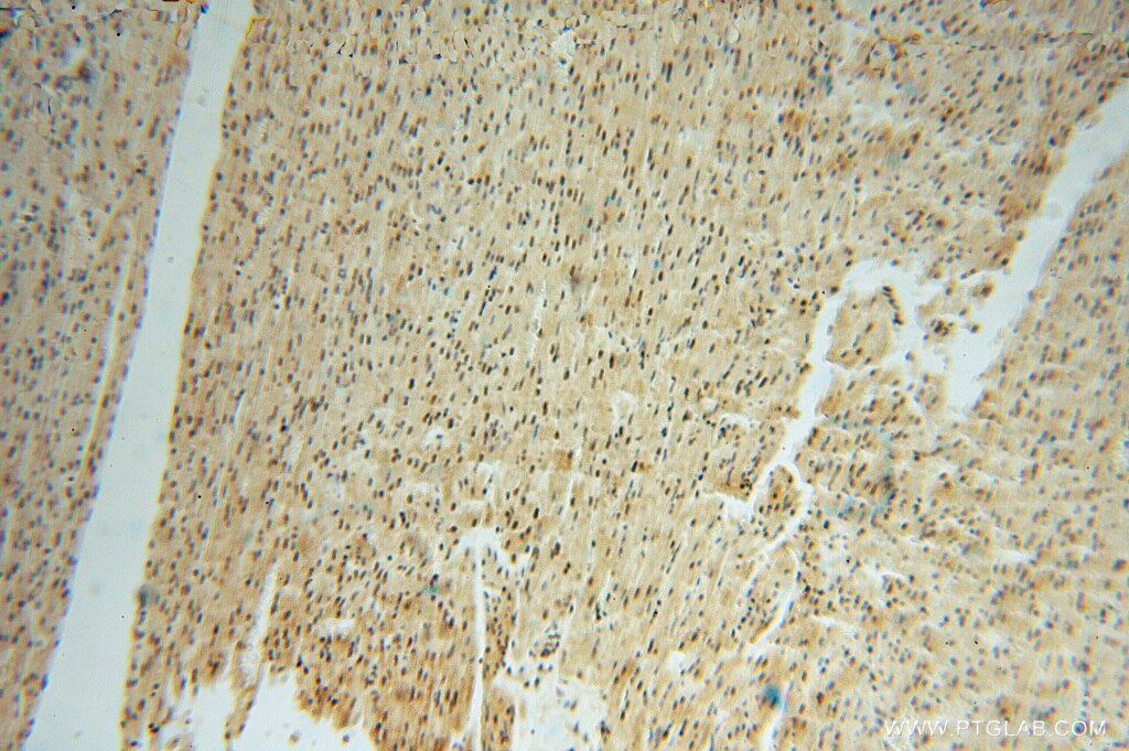 Immunohistochemistry (IHC) staining of human heart tissue using LENG9 Polyclonal antibody (16295-1-AP)