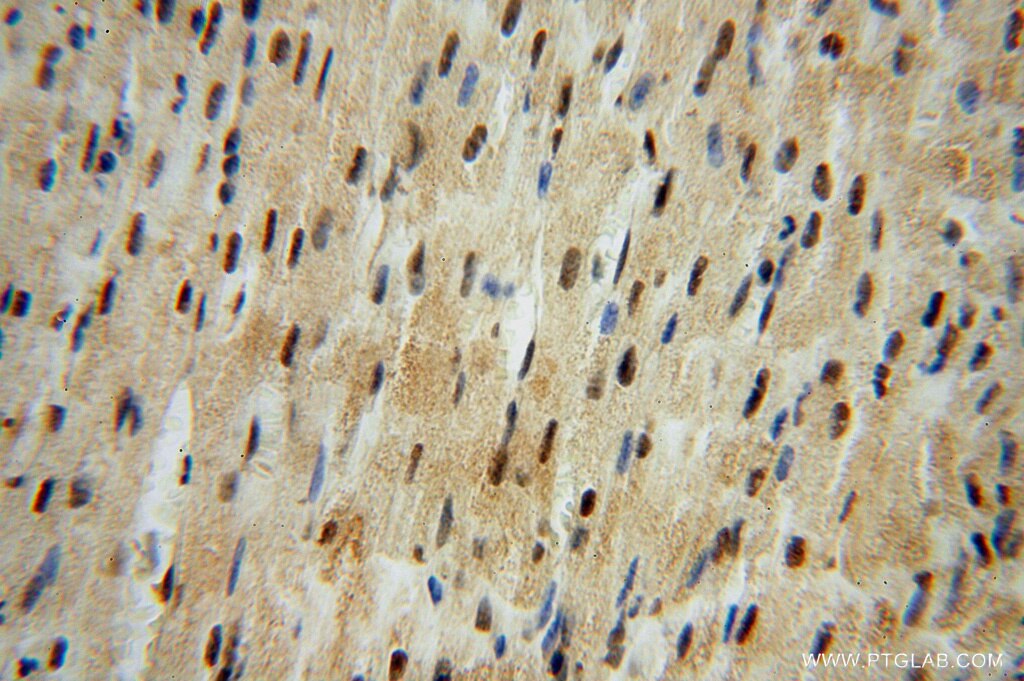 IHC staining of human heart using 16295-1-AP