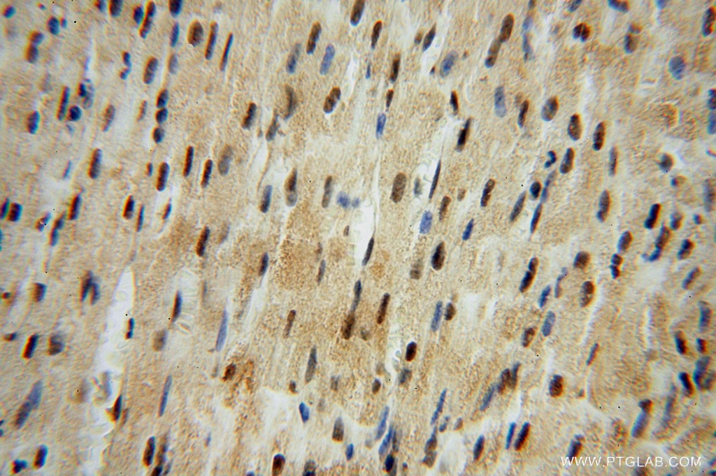 Immunohistochemistry (IHC) staining of human heart tissue using LENG9 Polyclonal antibody (16295-1-AP)