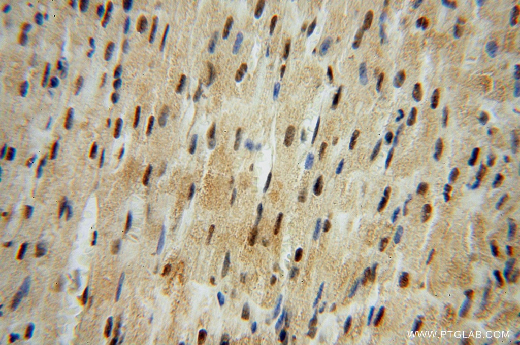 Immunohistochemistry (IHC) staining of human heart tissue using LENG9 Polyclonal antibody (16295-1-AP)