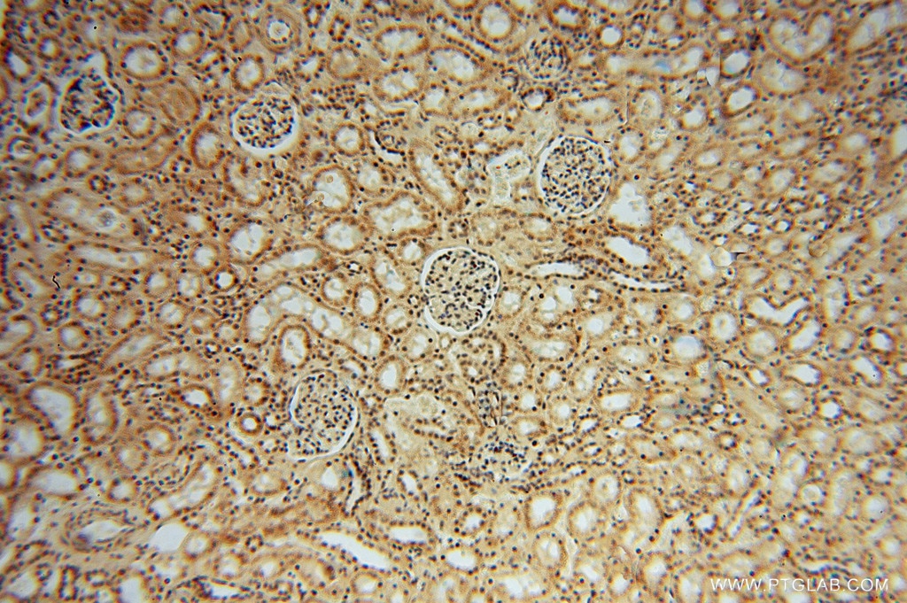 Immunohistochemistry (IHC) staining of human kidney tissue using LENG9 Polyclonal antibody (16295-1-AP)