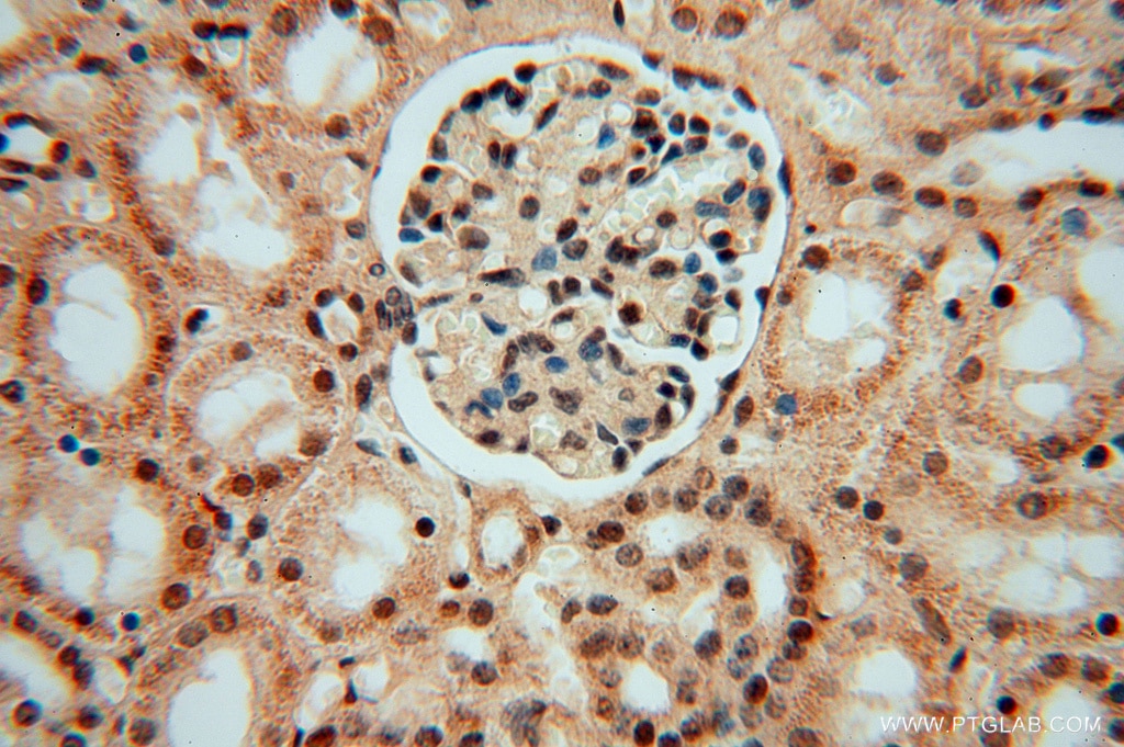 Immunohistochemistry (IHC) staining of human kidney tissue using LENG9 Polyclonal antibody (16295-1-AP)