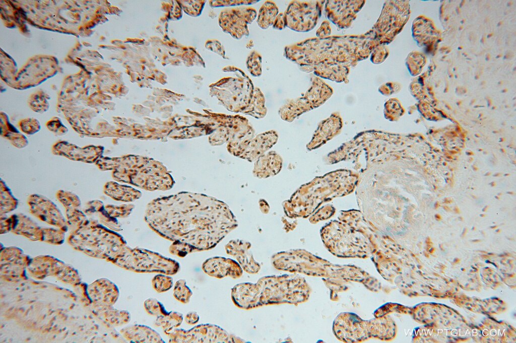 IHC staining of human placenta using 16295-1-AP