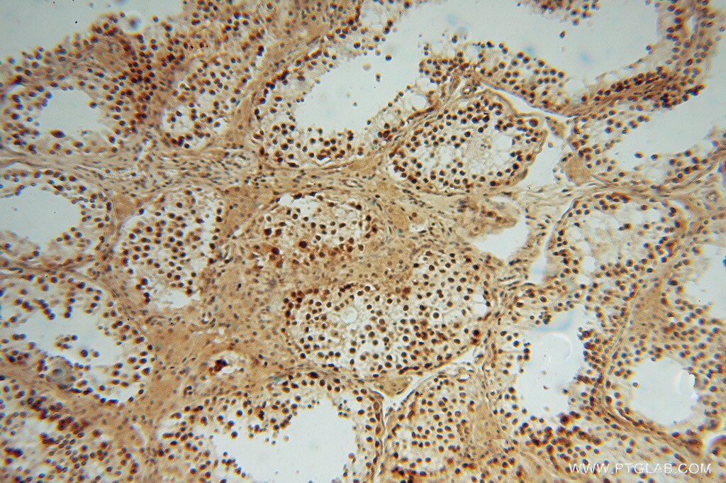 Immunohistochemistry (IHC) staining of human testis tissue using LENG9 Polyclonal antibody (16295-1-AP)