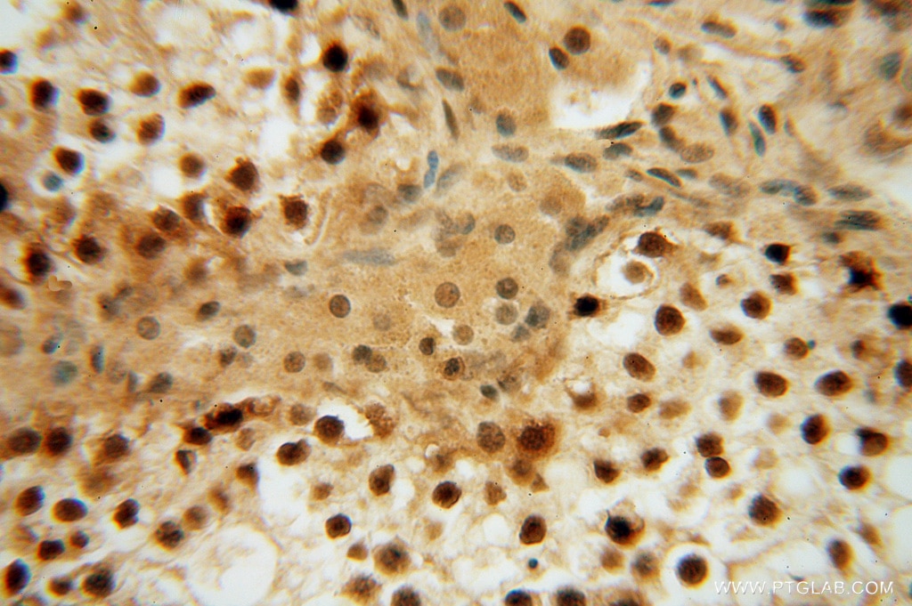 Immunohistochemistry (IHC) staining of human testis tissue using LENG9 Polyclonal antibody (16295-1-AP)