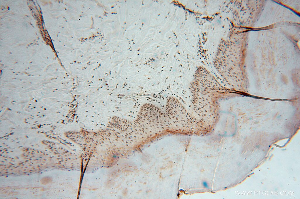 Immunohistochemistry (IHC) staining of human skin tissue using LENG9 Polyclonal antibody (16295-1-AP)