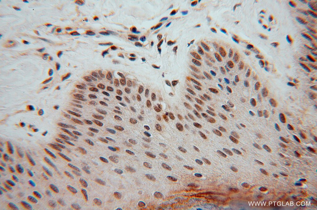 Immunohistochemistry (IHC) staining of human skin tissue using LENG9 Polyclonal antibody (16295-1-AP)