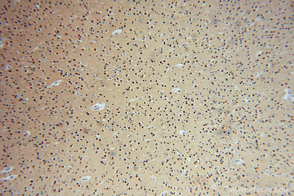 Immunohistochemistry (IHC) staining of human brain tissue using LENG9 Polyclonal antibody (16295-1-AP)
