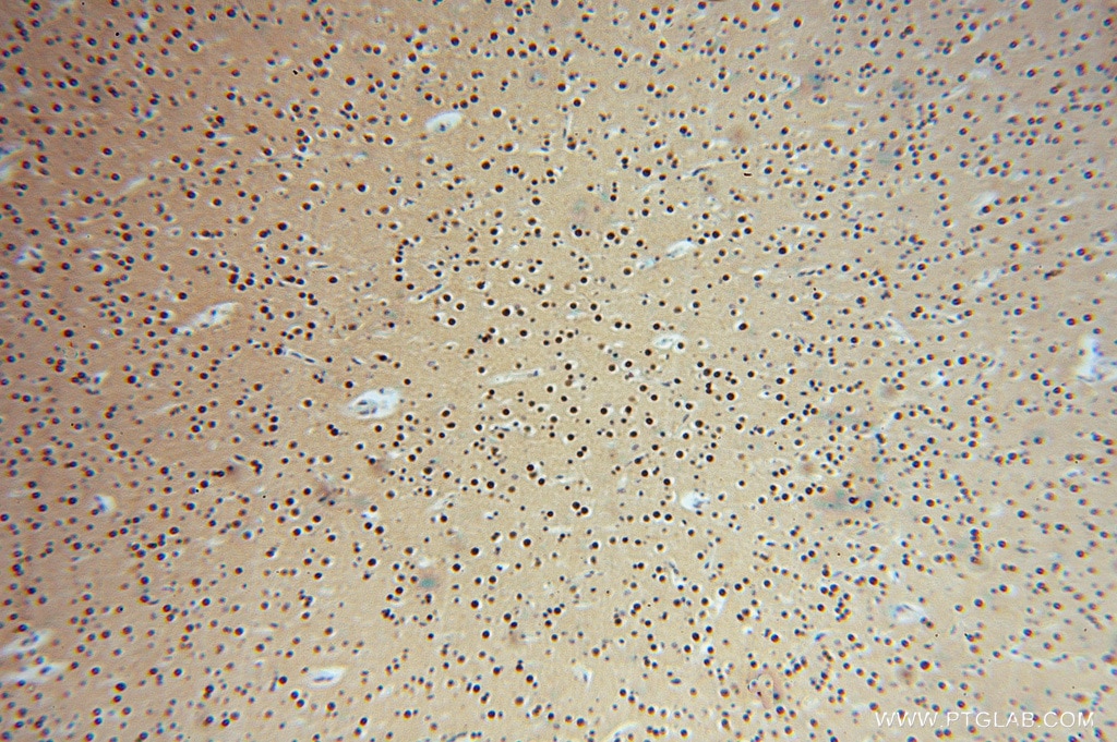 IHC staining of human brain using 16295-1-AP