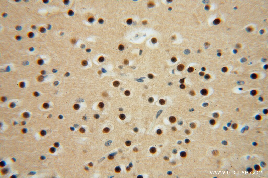 Immunohistochemistry (IHC) staining of human brain tissue using LENG9 Polyclonal antibody (16295-1-AP)