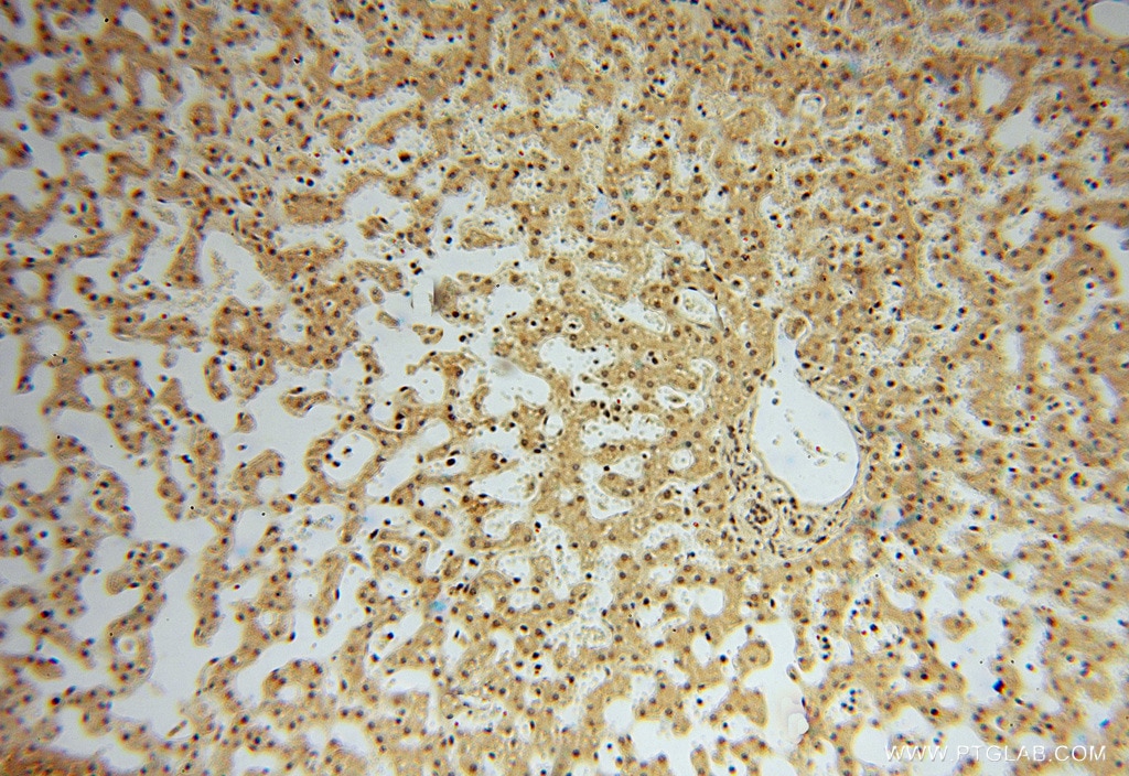 Immunohistochemistry (IHC) staining of human liver tissue using LENG9 Polyclonal antibody (16295-1-AP)