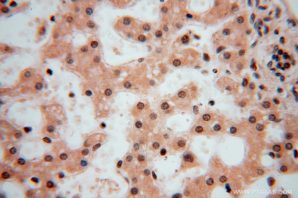 Immunohistochemistry (IHC) staining of human liver tissue using LENG9 Polyclonal antibody (16295-1-AP)