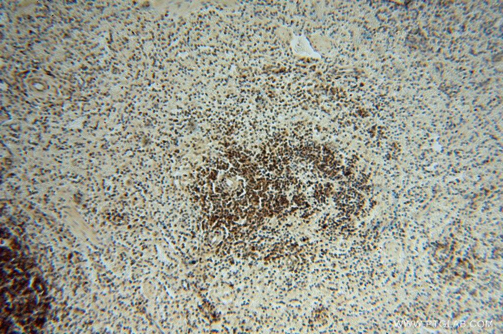 Immunohistochemistry (IHC) staining of human spleen tissue using LENG9 Polyclonal antibody (16295-1-AP)