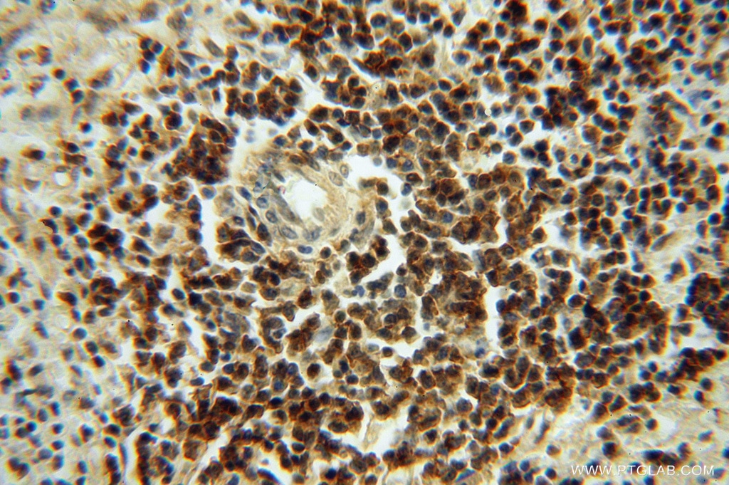 Immunohistochemistry (IHC) staining of human spleen tissue using LENG9 Polyclonal antibody (16295-1-AP)