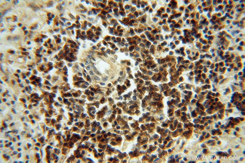 IHC staining of human spleen using 16295-1-AP