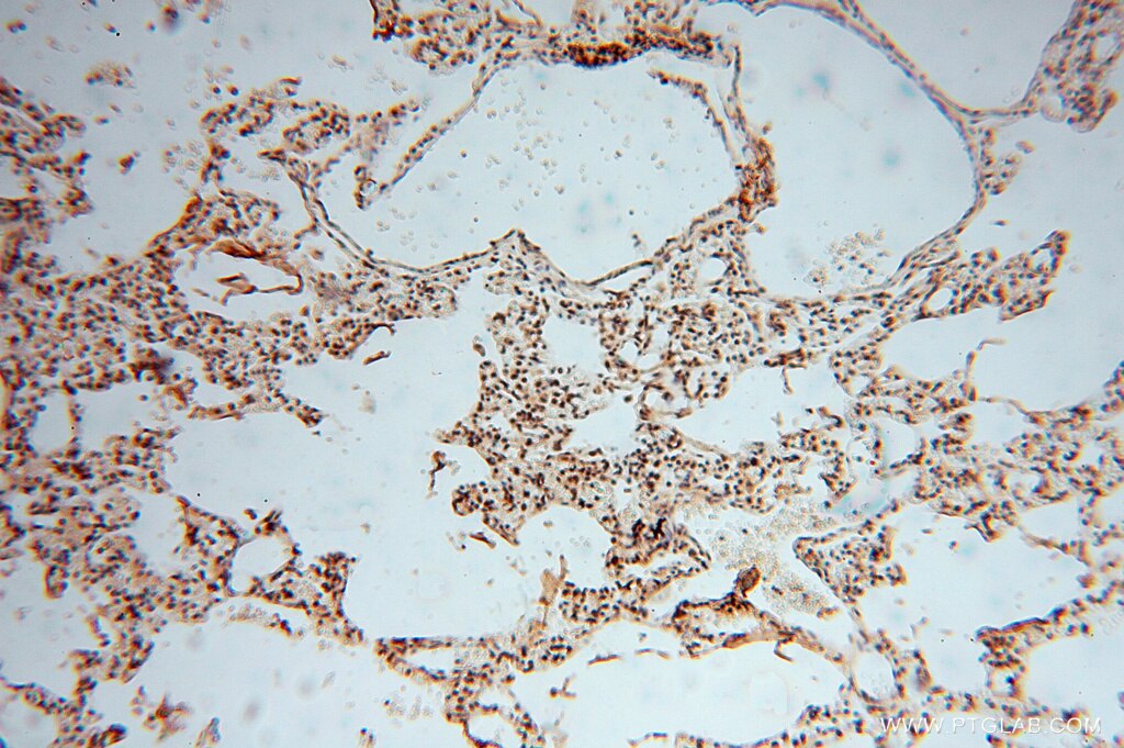 IHC staining of human lung using 16295-1-AP