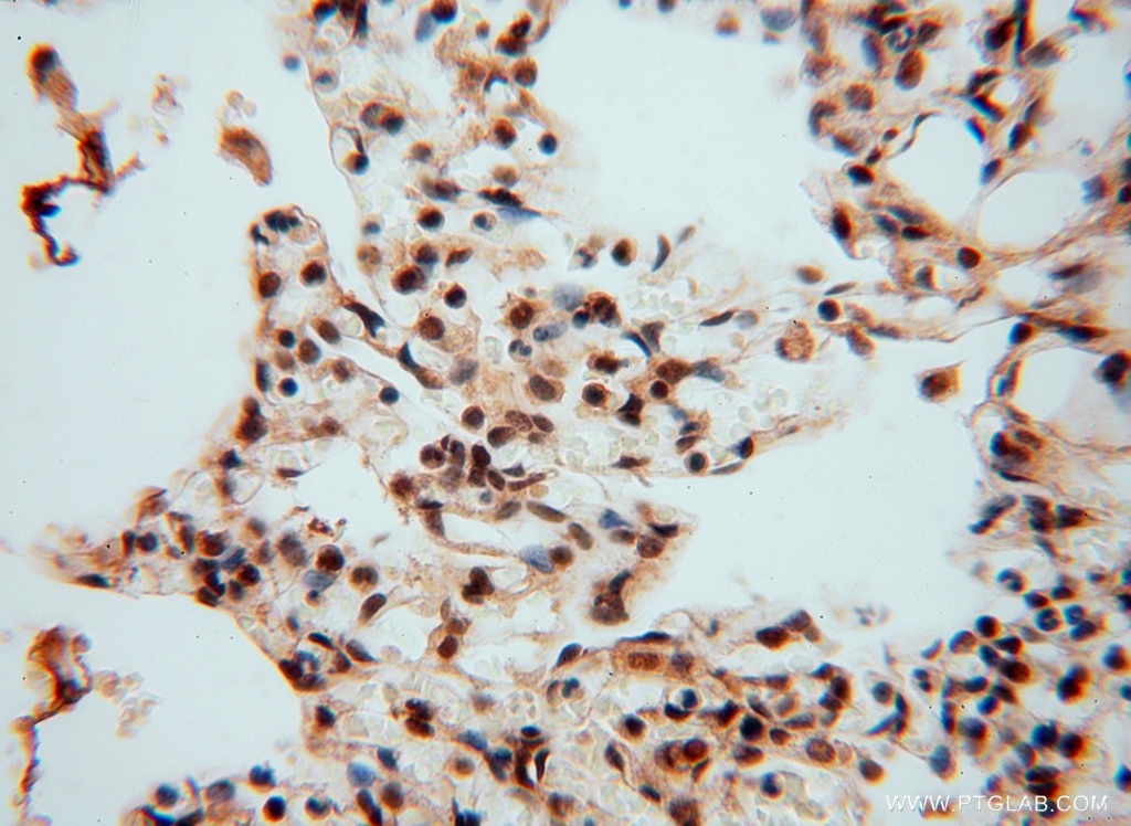 Immunohistochemistry (IHC) staining of human lung tissue using LENG9 Polyclonal antibody (16295-1-AP)