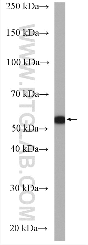 Western Blot (WB) analysis of HeLa cells using LENG9 Polyclonal antibody (16295-1-AP)
