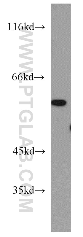 Western Blot (WB) analysis of Y79 cells using LENG9 Polyclonal antibody (16295-1-AP)