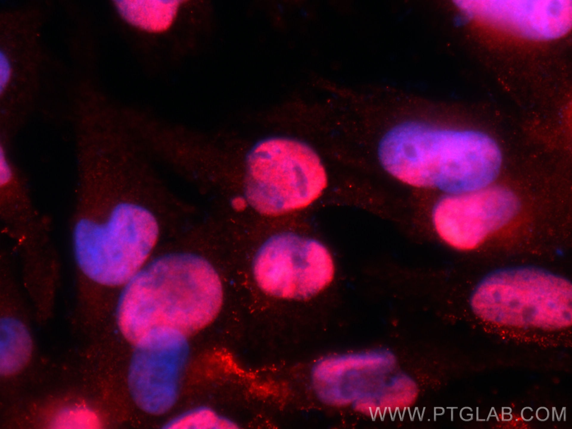 Immunofluorescence (IF) / fluorescent staining of U-251 cells using LEO1 Polyclonal antibody (12281-1-AP)