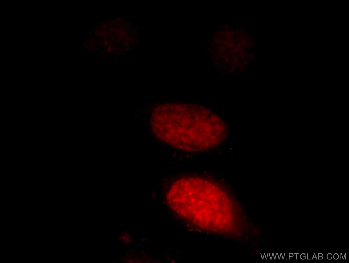 Immunofluorescence (IF) / fluorescent staining of HeLa cells using LEO1 Polyclonal antibody (12281-1-AP)